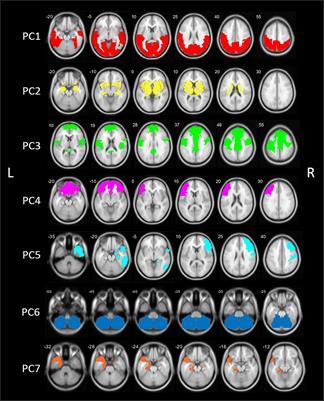 Identification of cholinergic centro-cingulate topography as main contributor to cognitive functioning in Parkinson’s disease: Results from a data-driven approach